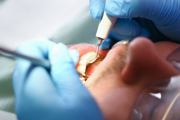 Best Emergency Treatment for Toothache in Newtown, PA